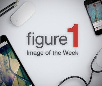 IOTW-SDN small