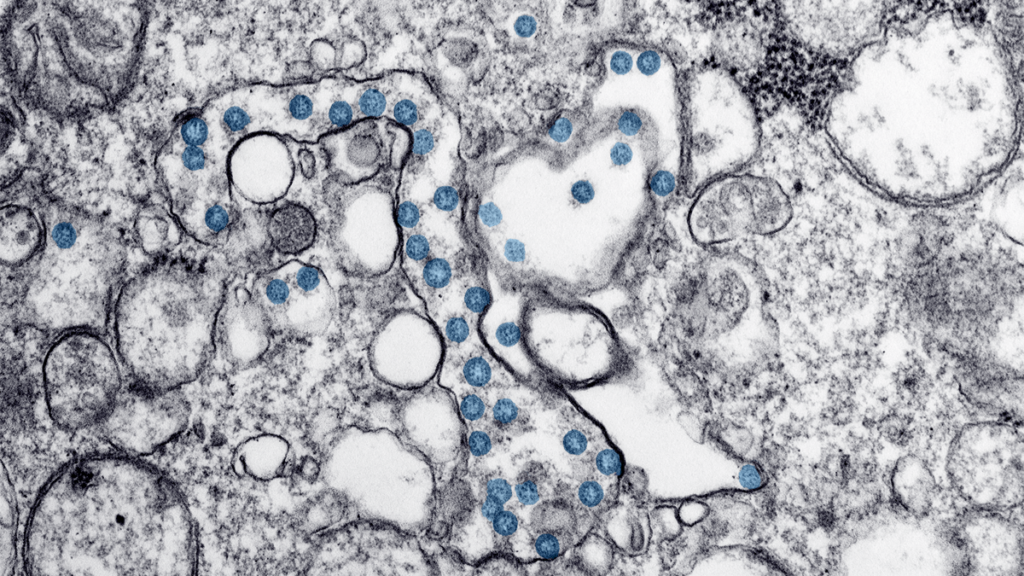 Match Days Cancelled Due to Coronavirus